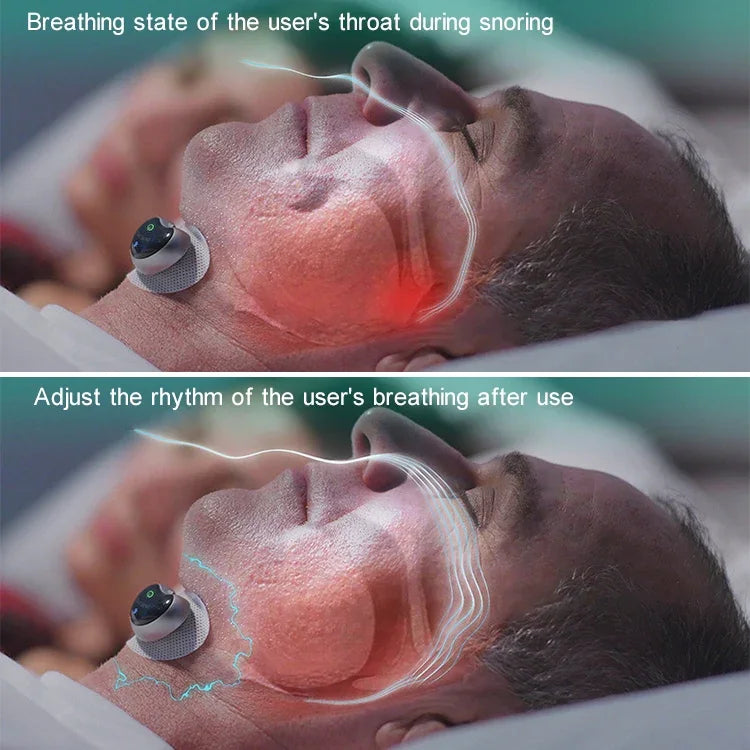 画像代替テキスト