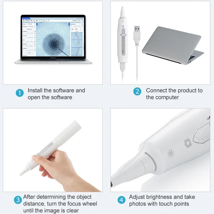 Supereyes Y008 Ear Nose Mouth Wireless Digital Electronic Endoscope, Y008