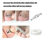 Orthopedic Buckle Toe Nail Groove Ingrown Nail Corrector, No. 36 Positive Nail Buckle, No. 38 Positive Nail Buckle, No. 40 Positive Nail Buckle, No. 42 Positive Nail Buckle, No. 44 Positive Nail Buckle, No. 36 Set, No. 38 Set, No. 40 Set, No. 42 Set   ...